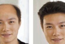 研究發現從事健身運動過多人易掉髮禿頭