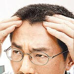 壓力大又熬夜 圓禿惡化1個變4個突然異常掉髮1個月應就醫