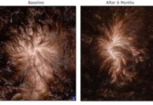 國外目前評價最高強調毫無副作用的外用品(男女適用)