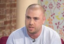 服藥治禿頭 英男慘變不舉