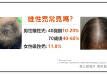 雄性禿懶人包 男女生都會雄性禿(男女性雄性禿)!